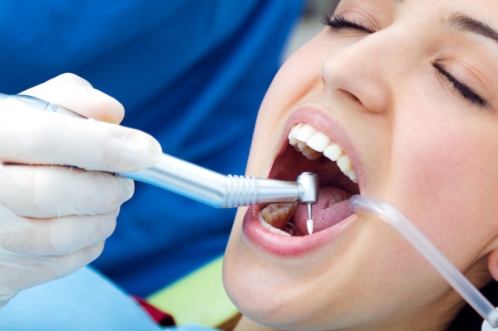 dental filling Santa Clarita